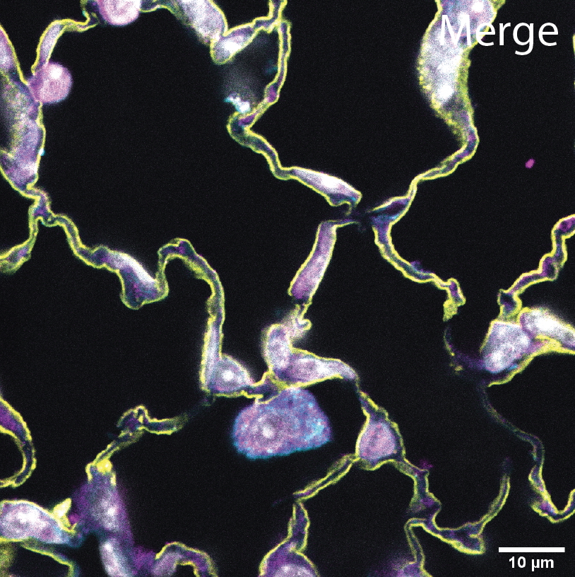 COPD Susceptibility Research